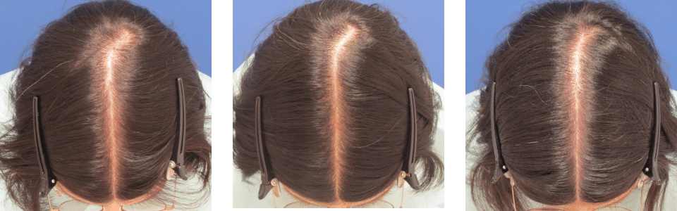 初診時4ヵ月後6ヵ月後