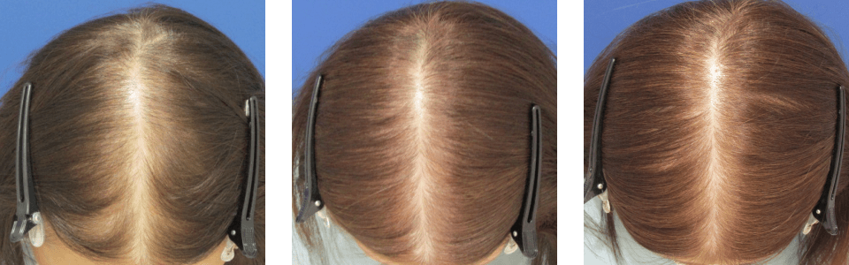 初診時4ヵ月後6ヵ月後