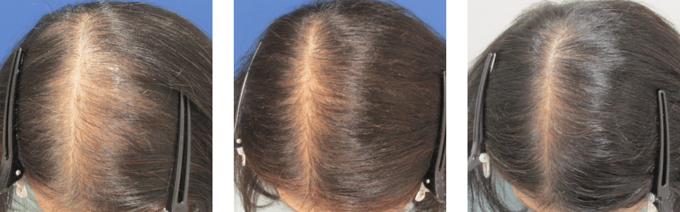 初診時6ヵ月後8ヵ月後