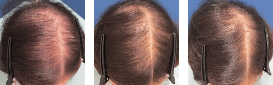 初診時4ヵ月後8ヵ月後