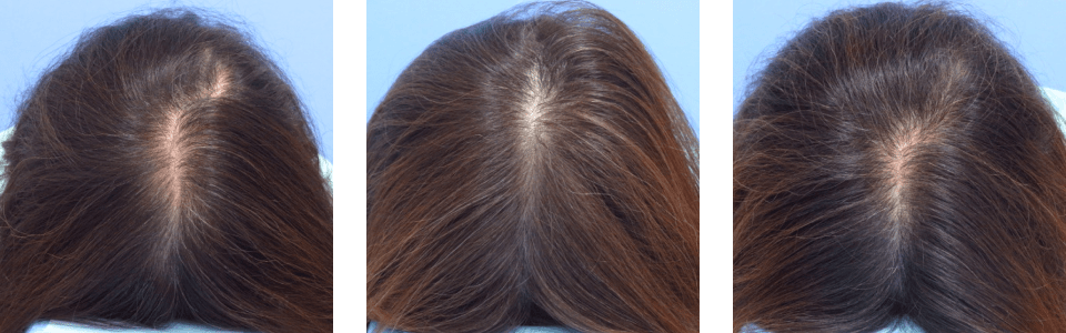 初診時7ヵ月後13ヵ月後