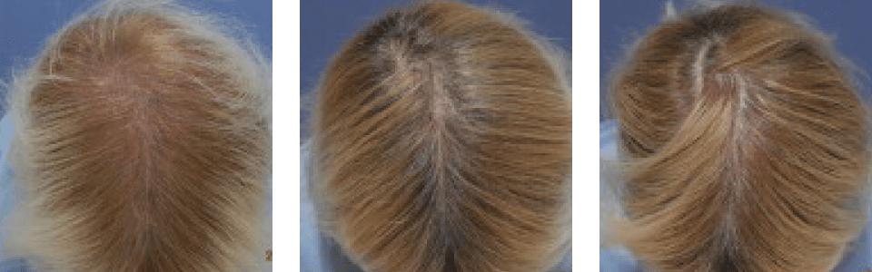 初診時3ヵ月後5ヵ月後