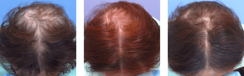 初診時3ヵ月後6ヵ月後