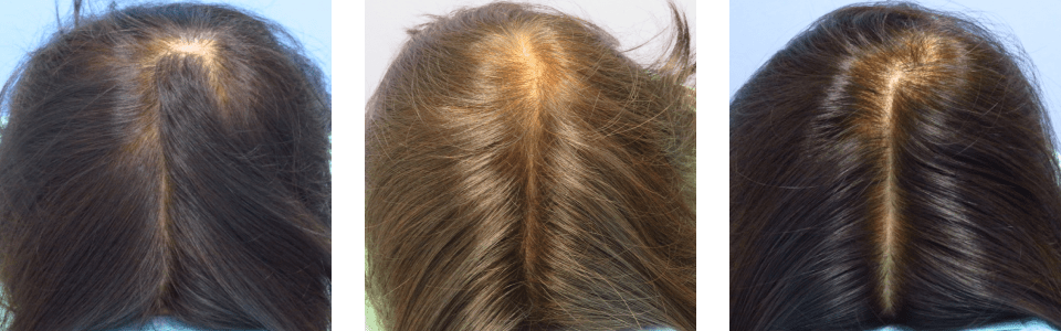 初診時4ヵ月後10ヵ月後