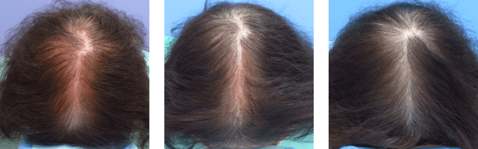 初診時4ヵ月後14ヵ月後