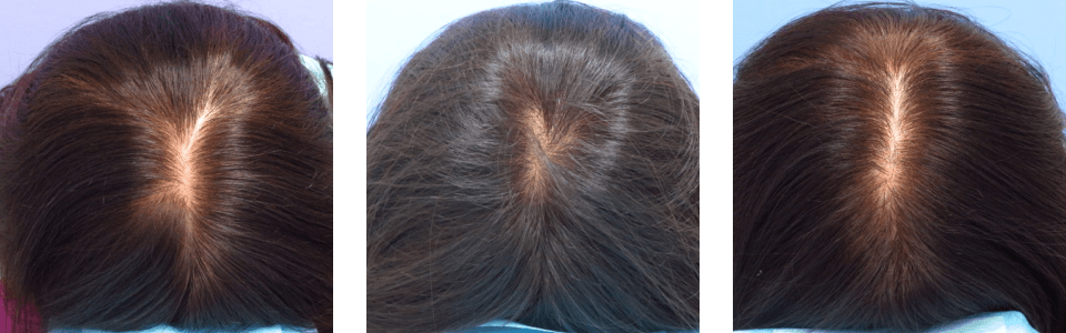 初診時6ヵ月後13ヵ月後