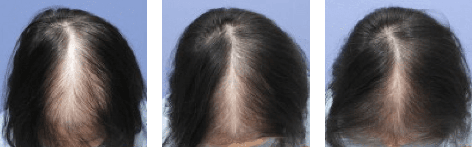 初診時3ヵ月後5ヵ月後