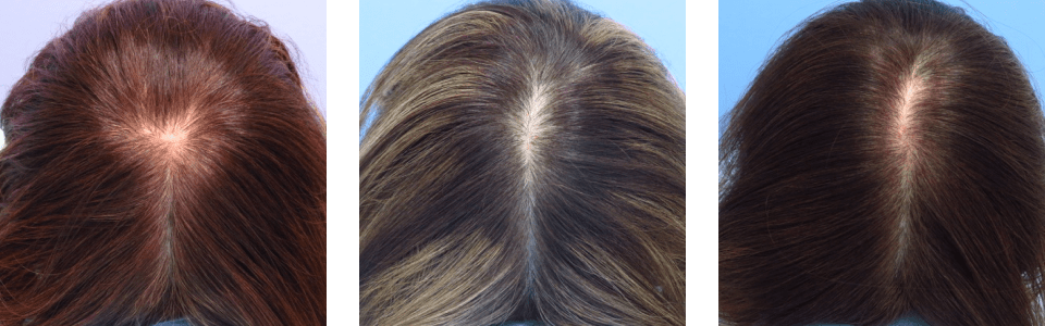 初診時6ヵ月後16ヵ月後