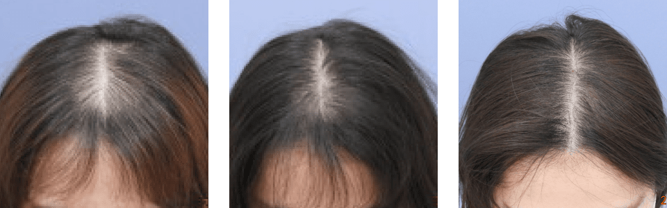 初診時6ヵ月後9ヵ月後