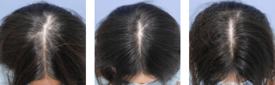 初診時3ヵ月後5ヵ月後