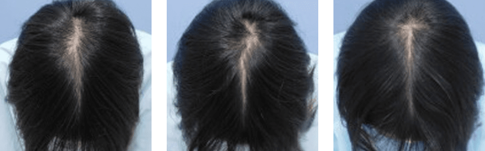 初診時3ヵ月後5ヵ月後