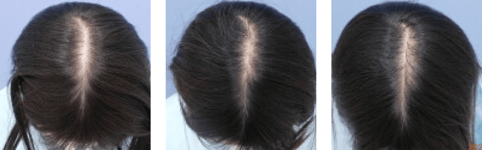 初診時3ヵ月後6ヵ月後