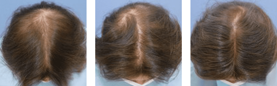 初診時3ヵ月後5ヵ月後