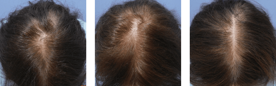 初診時3ヵ月後6ヵ月後