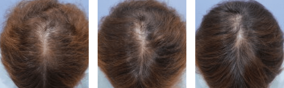 初診時3ヵ月後6ヵ月後