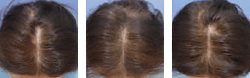 初診時2ヵ月後6ヵ月後