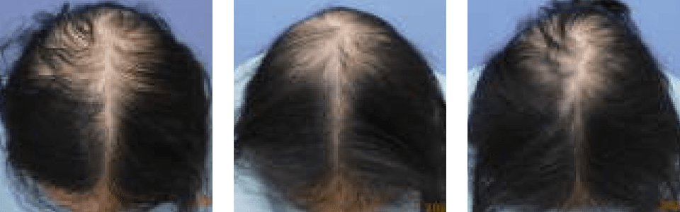 初診時4ヵ月後8ヵ月後