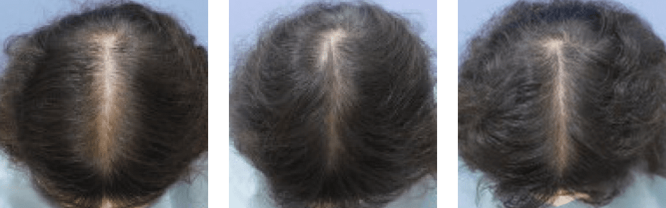 初診時5ヵ月後11ヵ月後