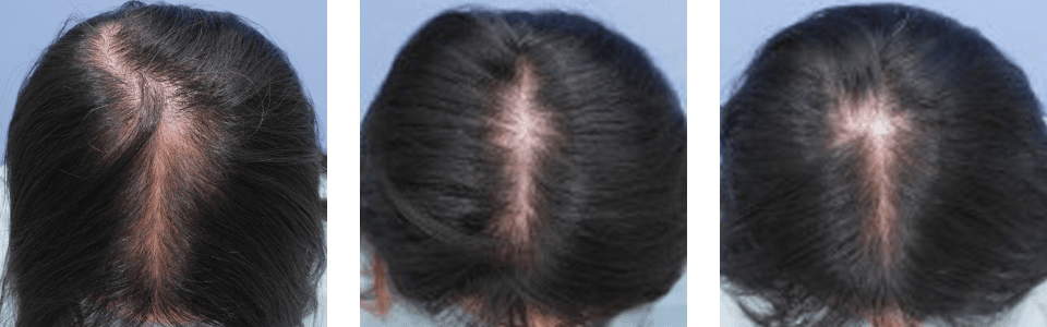 初診時6ヵ月後12ヵ月後