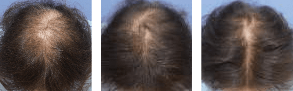 初診時3ヵ月後8ヵ月後