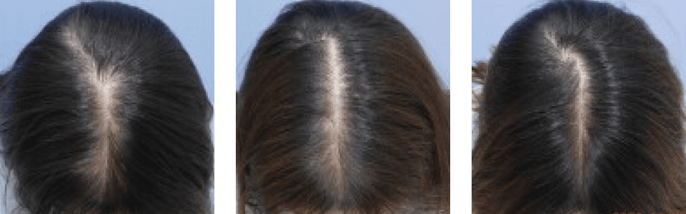 初診時4ヵ月後9ヵ月後