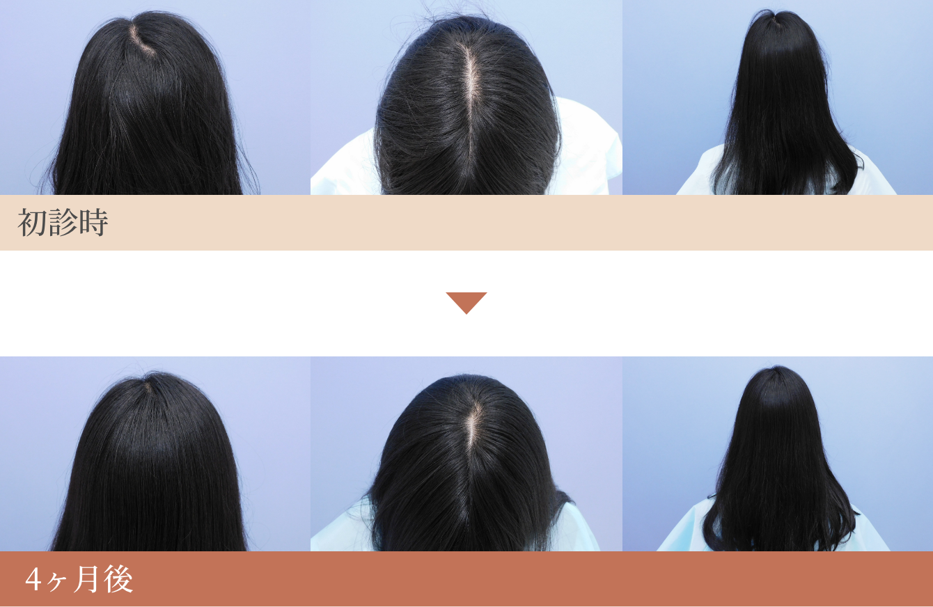 美髪治療_症例