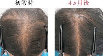 初診時 4ヵ月後