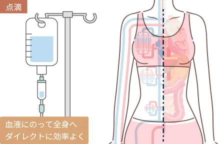 美容にもなる点滴・注射とは