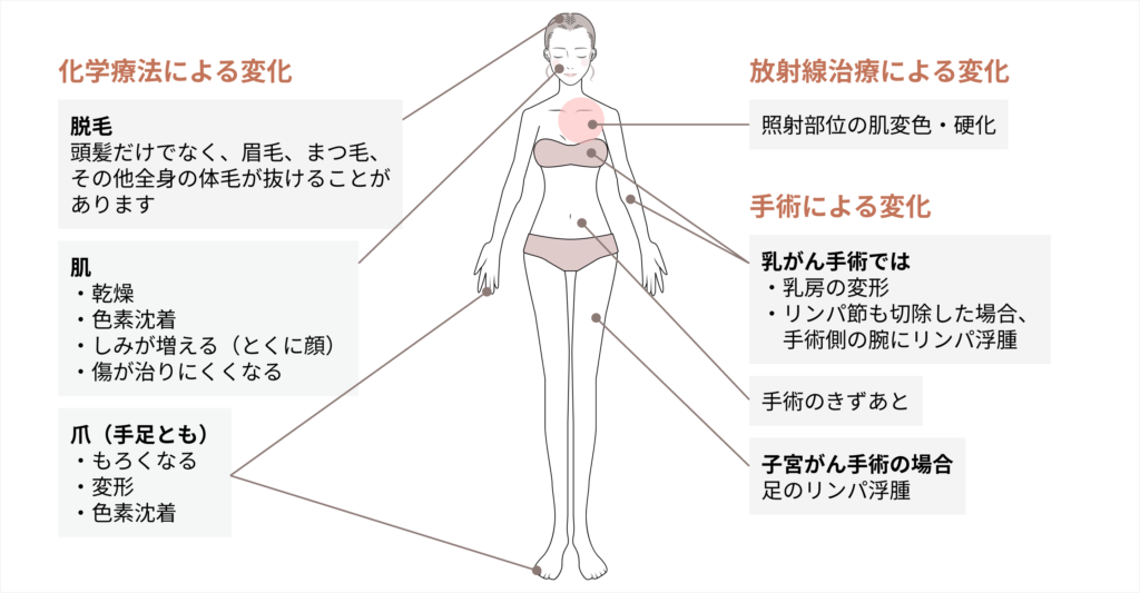 化学療法による変化/放射線治療による変化/手術による変化 のイメージ