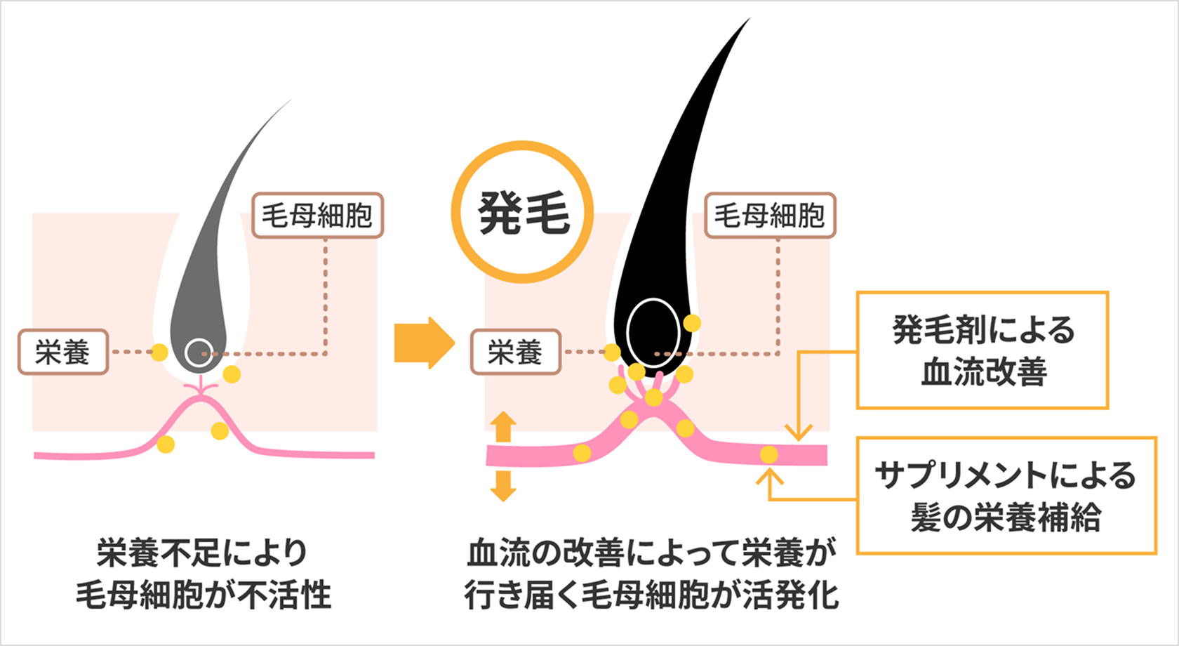 栄養不足により毛母細胞が不活性 → 血流の改善によって栄養が行き届く 毛母細胞が活性化