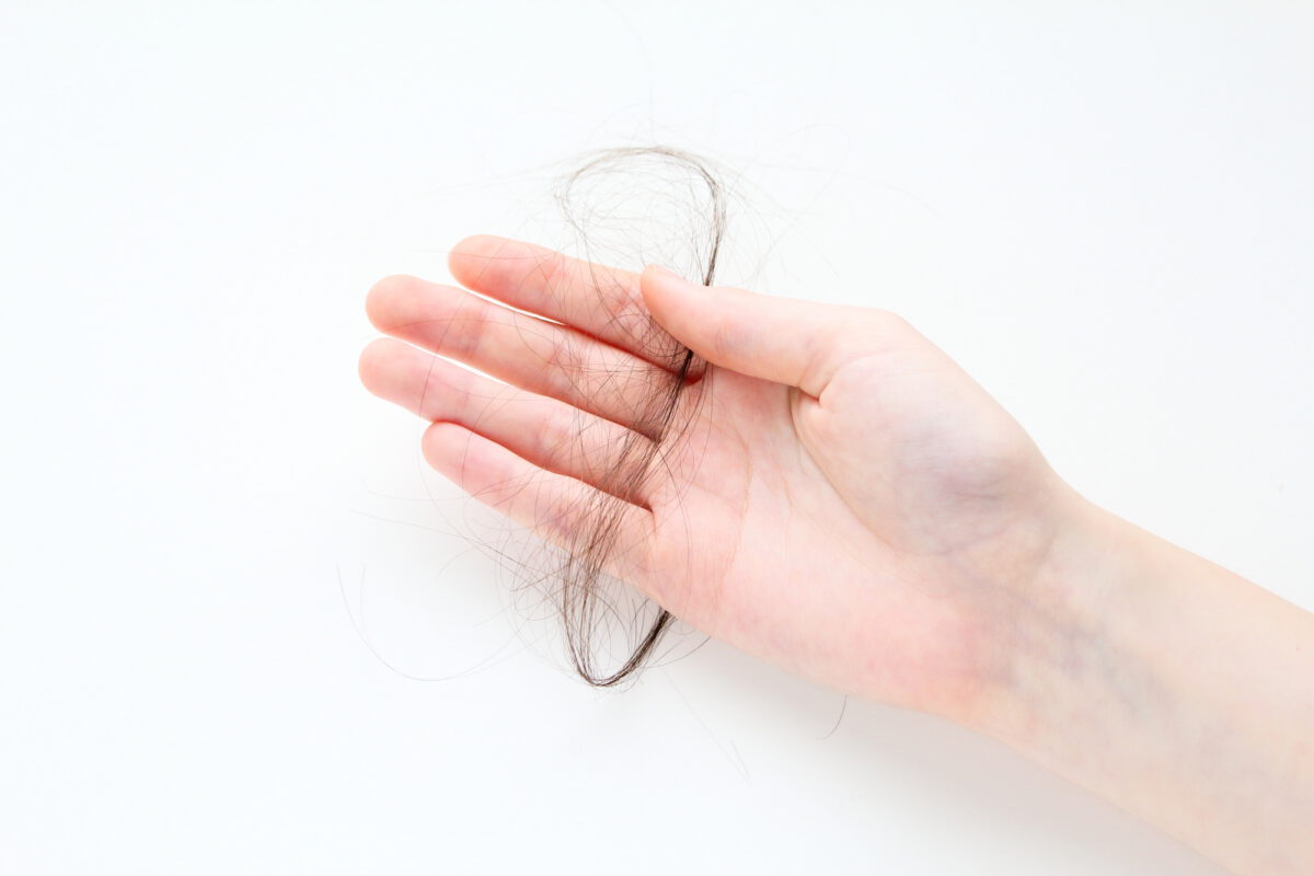 頭皮に大量のフケかゆみがでる粃糠性湿疹（脱毛症）の原因と対策