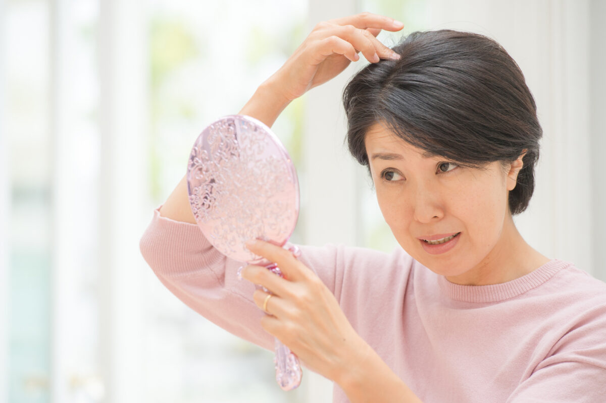 女性特有の薄毛FAGAの原因と治療法は？