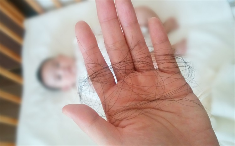 【クリニック監修】いつまで抜け続けるの？産後の抜け毛